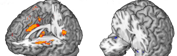 cerveau_corrado.jpeg